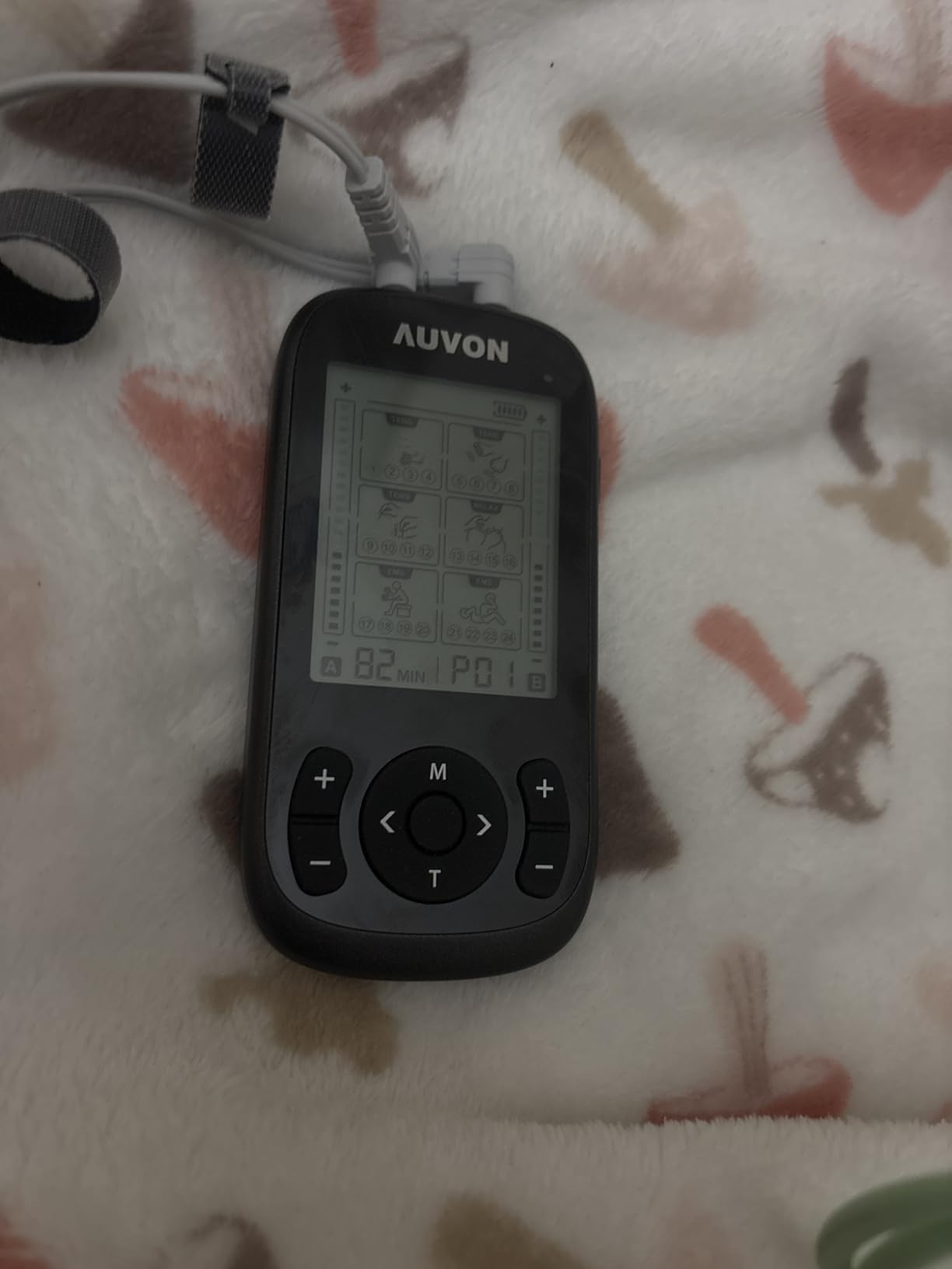 AUVON 3-in-1 TENS Unit Muscle Stimulator, 40 Levels for Gradual Pain Relief | EMS Massage Machine, Drug-Free for Shoulder, Sciatica, Back Pain Relief, 24 Modes Electronic Pulse Massager customer photo 1